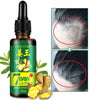 7 Days Hair Growth Spray – Germinal Serum Oil for Fast & Natural Hair Growth 30ML