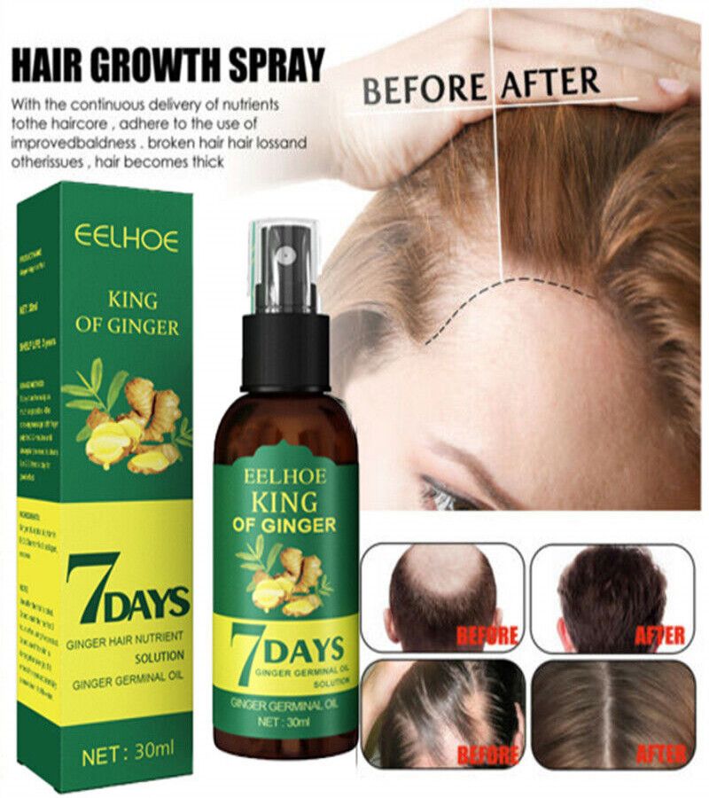7 Days Hair Growth Spray – Germinal Serum Oil for Fast & Natural Hair Growth 30ML