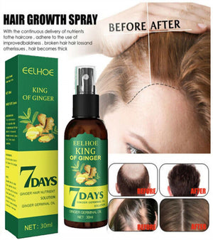 7 Days Hair Growth Spray – Germinal Serum Oil for Fast & Natural Hair Growth 30ML
