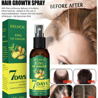 7 Days Hair Growth Spray – Germinal Serum Oil for Fast & Natural Hair Growth 30ML